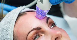 Microneedling RF